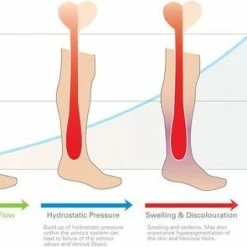 Hete verkoop ???? Merkloos Duopack Compressiekousen / Steunkousen - Elastische Hardloop / Sport / Vliegtuig Compressie Sokken - Running Travel Sock - Reissokken / Reis Kousen - Heren/Dames - Wit ???? -XXL Nutrition-winkel 550x295 2